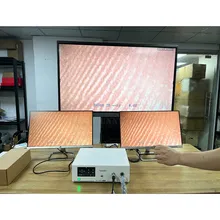 Sy-PS048t Nuovo Arrivo Telecamera HD Endoscopio Rigido Sistema di Telecamera e Fonte di Luce Integrata