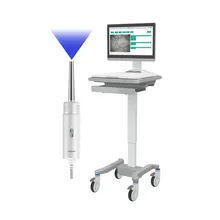 Draagbare sublinguale microcirculatie microscoop met geavanceerde beeldtechnologie