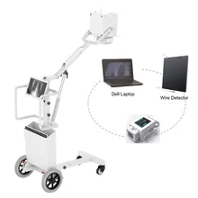 IN-8KW Máquina de Rayos X Digital Portátil Sistema de Radiografía Digital para Uso Humano