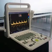 Sistema de ultrasonido digital de color de flujo avanzado de alta precisión multifuncional
