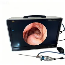 Hệ thống camera nội soi di động Full HD