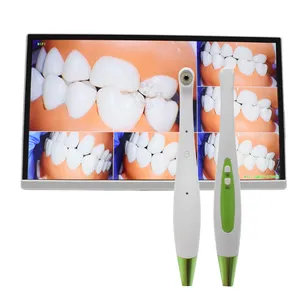 Dental Computer Integrated Endoscope HD Camera Ai Image System