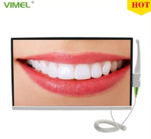 Dental Computer Integrated Endoscope HD Camera Ai Image System