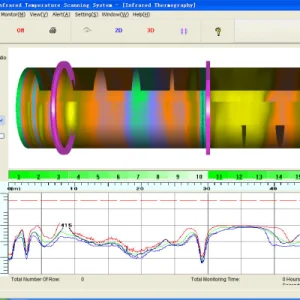 Kiln Shell Temperature Measurement Scanning System