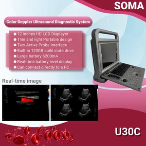 U30c Tragbares 12.1-Inch Hochauflösungsdisplay Farb-Doppler-Ultraschall-Diagnosesystem